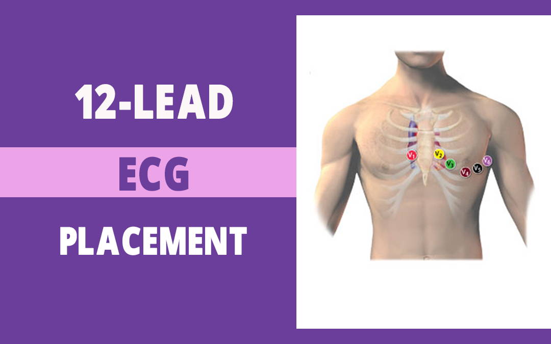 Portable 12 Lead ECG Machine for Professional Usage 3 Channel EKG
